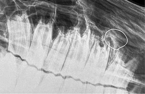 Figure 10. A laterodorsal-lateroventral radiograph with a metallic marker positioned around a facial swelling, identifying a periapical lucency surrounded by a region of sclerosis of the 07 tooth.