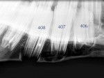 Figure 7. Radiographic appearance of a juvenile 408 and gradually developing roots of the older 407 and 406.