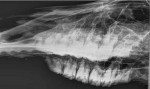 Figure 8. Radiographic appearance of an aged tooth.