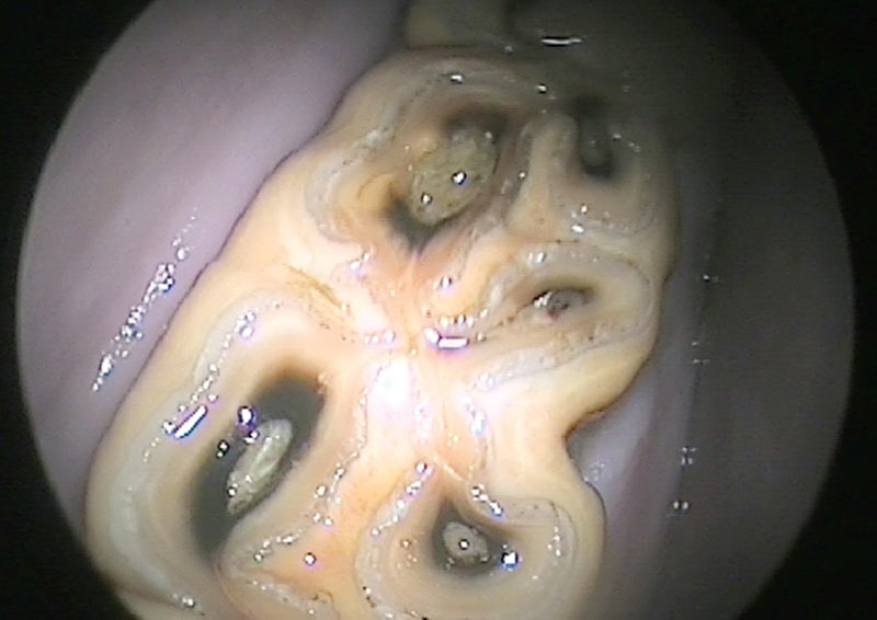 Figure 1. An oral endoscopic view of the occlusal surface of a mandibular cheek tooth with loss of secondary dentine and exposure of the pulps.