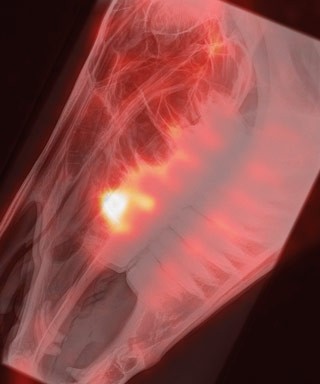 Figure 5. A scintigram overlaying a radiograph showing an area of increased radionuclide uptake associated with an apical infection. Image: Marcus Head.