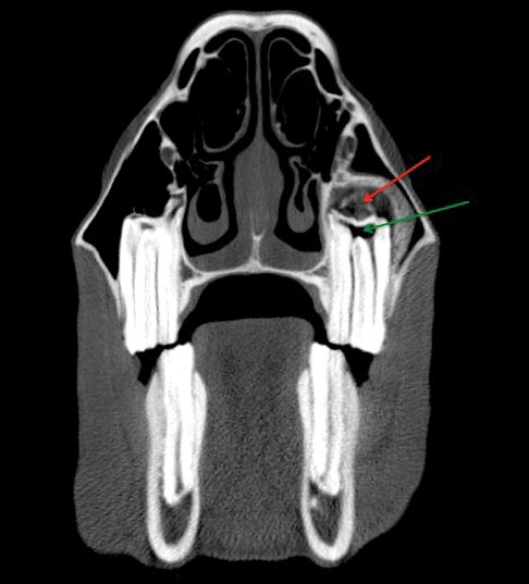 Figure 6. A CT image showing changes synonymous with apical infection, including expansion of the alveolus (red arrow) and hypoattenuation within the pulp horns (green arrow) due to the presence of gas.
