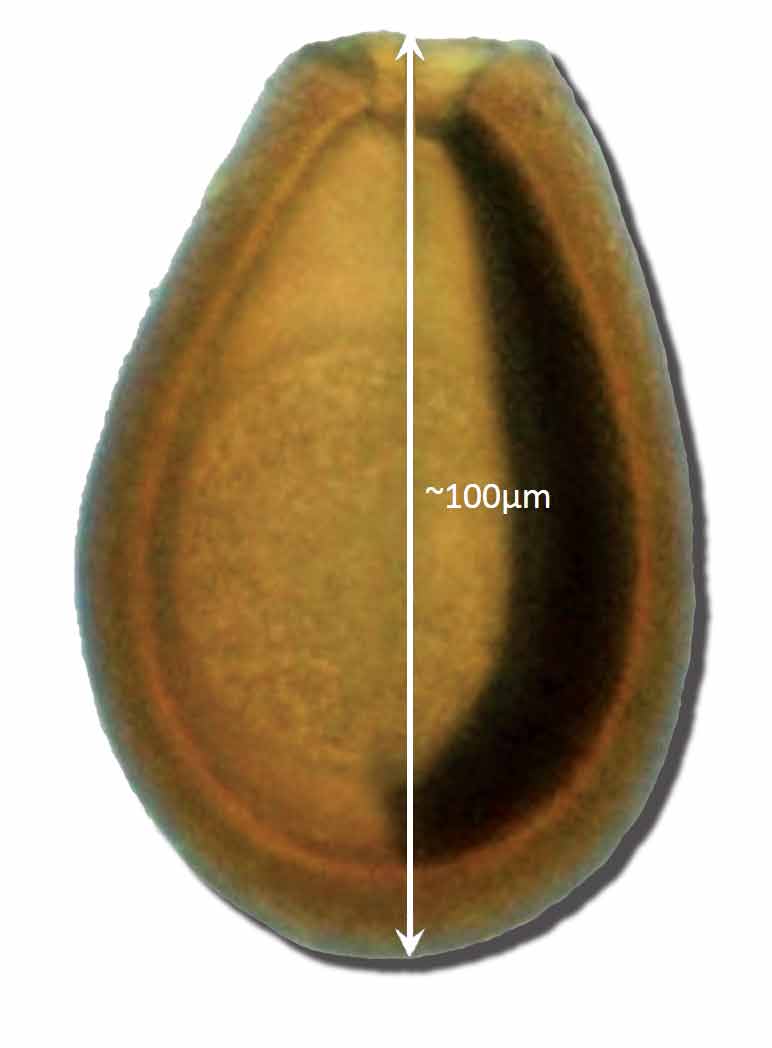 Figure 2. Oocyst of Eimeria macusaniensis.