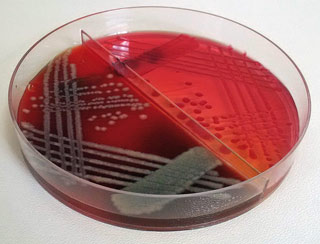 Figure 1. Escherichia coli growth on blood agar and MacConkey culture plate.