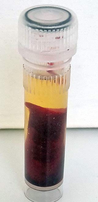 Figure 2. A blood sample. 