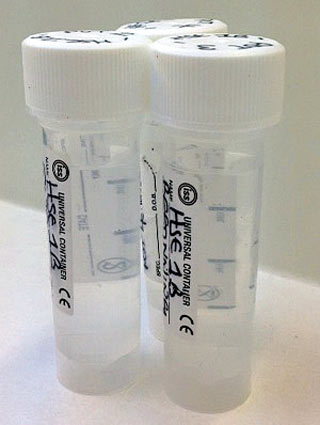 Figure 3. Water samples.