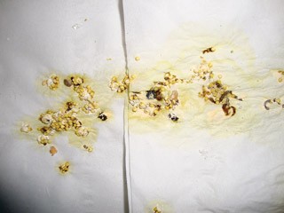 Figure 2. Undigested seed in the faeces of a cockatiel with suspected proventricular dilatation syndrome.