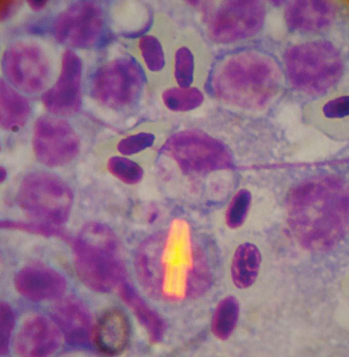 Figure 5. Isospora serini inclusions in an impression smear from a finch.