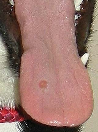Cutaneous and renal glomerular vasculopathy lesions present on the tongue.