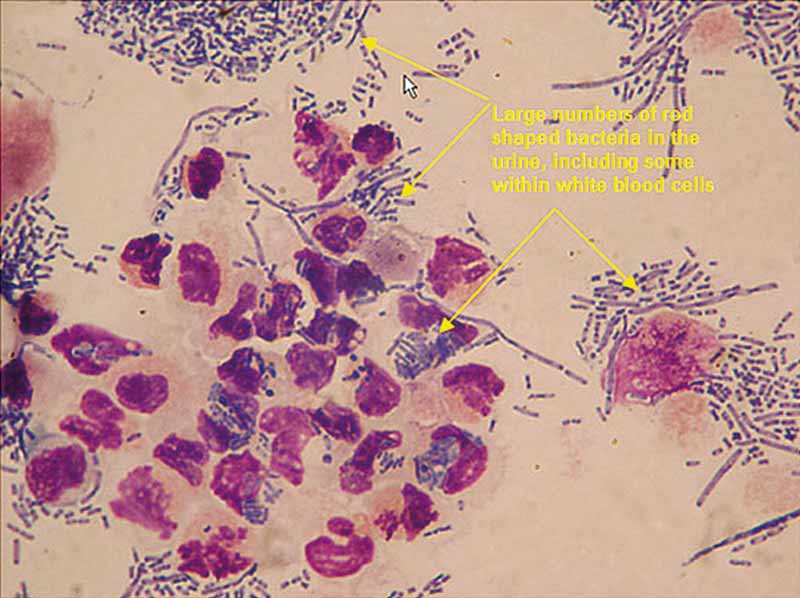 Figure 2. In-clinic examination of urine sediment used in the place of bacterial urine cultures for cats with chronic kidney disease.