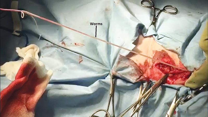 Figure 3. Heartworms being removed. 