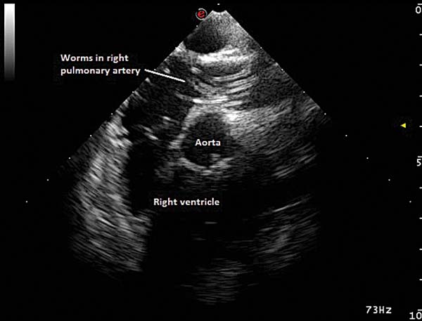 Figure 4a. Adult heartworms are visible inside the right pulmonary artery.