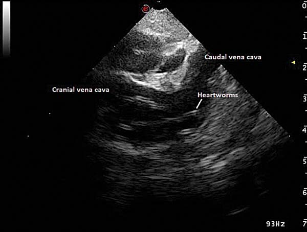 Figure 5. Transoesophageal echocardiography of heartworms inside the right atrium.