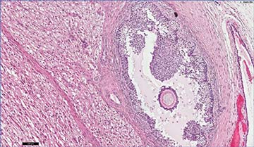 Figures 5a and 5b. In this dog, histopathology of excised tissue confirms the removal of ovarian tissue (a) and cystic uterine tissue. No neoplastic changes were identified in this case. 