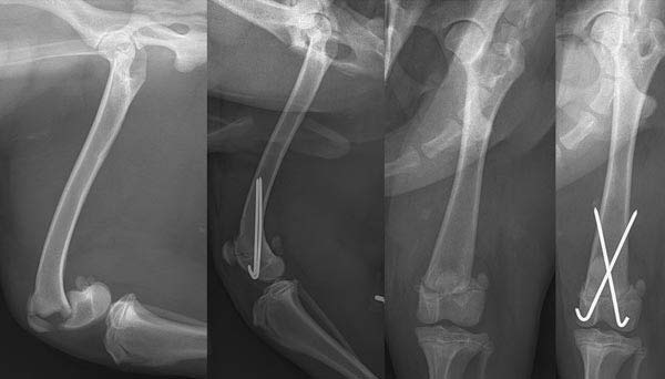 Figure 3. Mediolateral (left) and caudocranial (right) radiographs of a seven-month-old cocker spaniel with a Salter-Harris type one fracture of the distal femur. This has been stabilised with crossed Kirschner wires.
