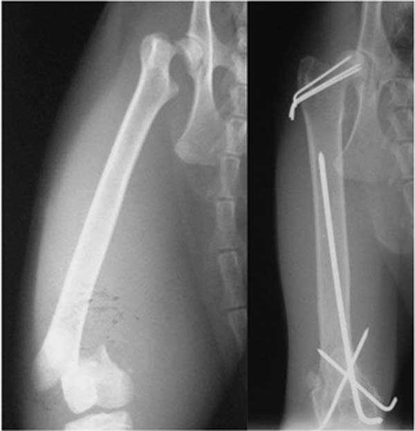 Figure 2. Caudocranial radiographs of a skeletally immature cat with a Salter-Harris type one fracture of the proximal femoral capital physis and a Salter-Harris type two fracture of the distal femoral physis (left). The fractures have been stabilised with three parallel Kirschner wires (K-wires) in the femoral neck/head and three crossed K-wires in the distal femoral physis (right).