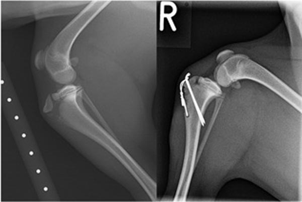 Figure 4. Mediolateral radiographs of the stifle of a six-month-old Yorkshire terrier with a Salter-Harris type one fracture of the tibial tuberosity (left). This has been stabilised with a Kirschner wire and a figure of eight tension band wire (right).