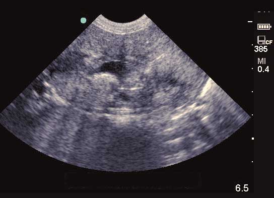 Figure 2a. Ultrasound appearance of diseased kidneys.