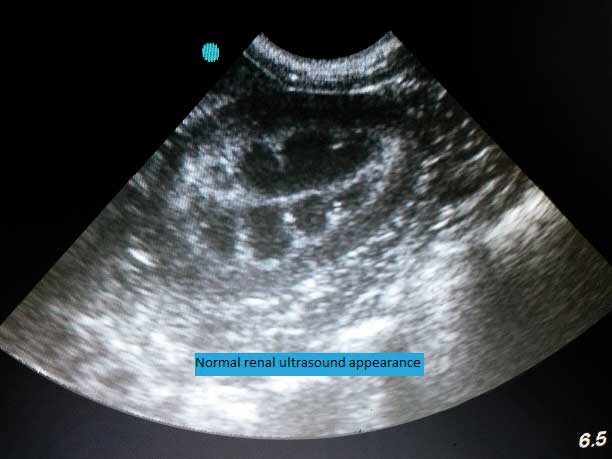 Figure 2b. Ultrasound appearance of normal kidneys.