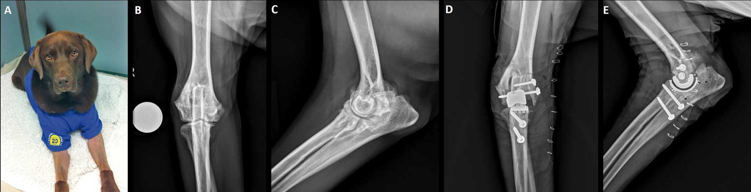 Figure 2. A Labrador with severe osteoarthritis of both elbows secondary to medial coronoid process disease, more severe on the right. It was treated initially with arthroscopic debridement at 18 months of age (A), but at four years of age, osteoarthritis had progressed and was non-responsive to multimodal medical management necessitating total elbow replacement on the right. Radiographs show preoperative craniocaudal (B) and mediolateral (C) views and immediate postoperative craniocaudal (D) and mediolateral (E) views. 