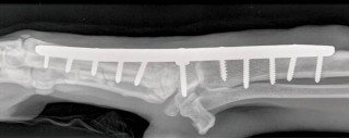 Figure 5. Mediolateral radiograph of a pancarpal arthrodesis using a dorsal plate. Note the washer between the plate and the radiocarpal bone, and the use of a cancellous screw in the distal radius.