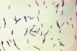 Figure 2. Clostridium perfringens is a ubiquitous bacteria whose toxins cause the enterotoxaemia clostridial diseases.