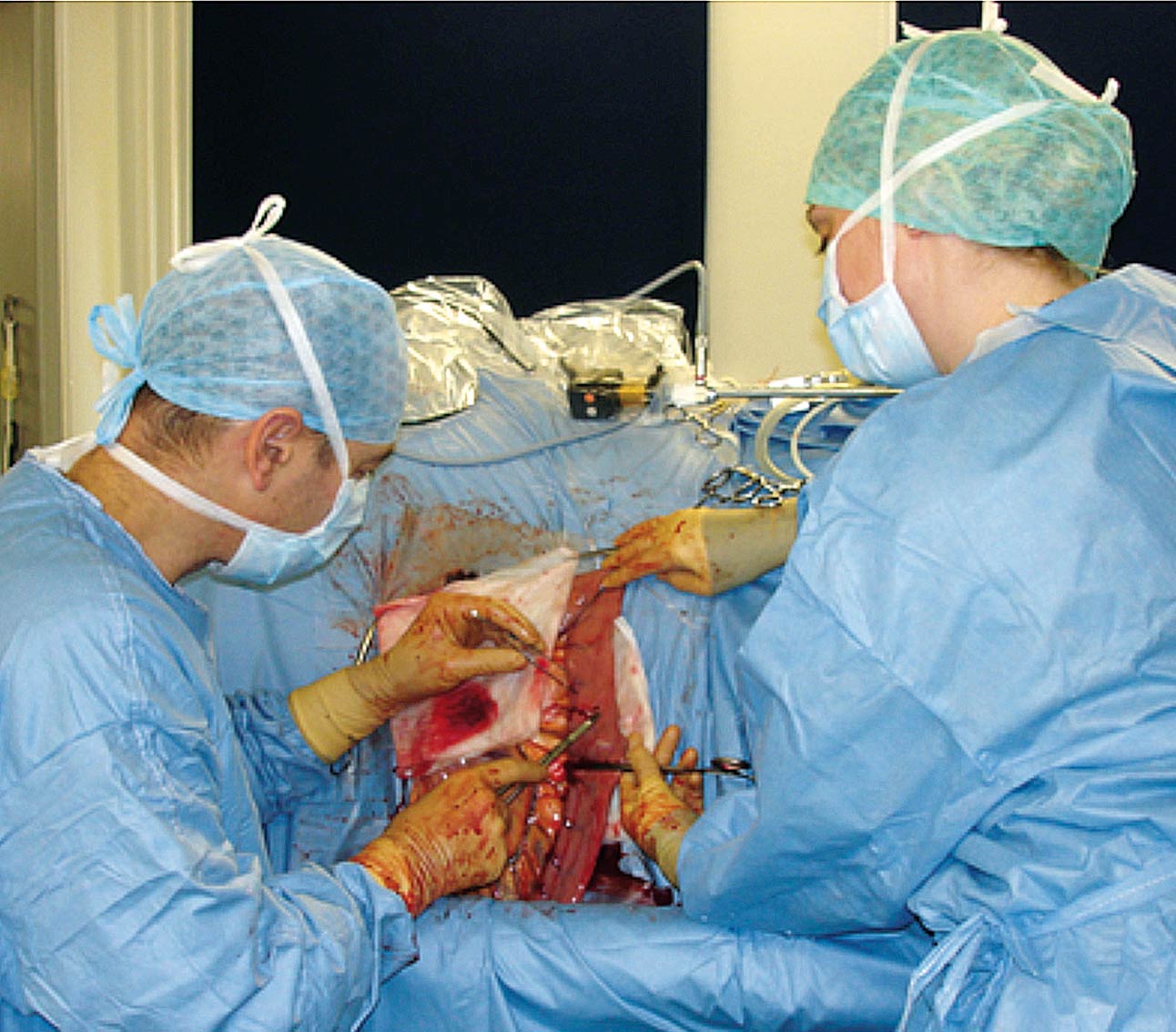 Figure 4. Laparoscopic-assisted flank laparotomy to biopsy small intestine. Image: Dylan Gorvy and Laura Hirvinen/Strömsholm Equine Referral Hospital.