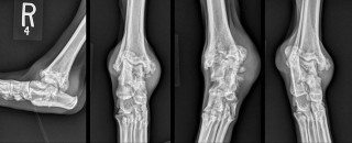 Figure 1. Mediolateral, caudocranial and two oblique views of the talocrural joint of a three-year-old Newfoundland with severe osteoarthritis secondary to an osteochondritis dissecans lesion affecting the medial trochlear ridge of the talus. This dog did not respond satisfactorily to conventional medical or surgical management.