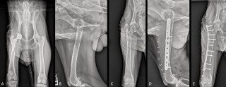 Figure 2. A ventrodorsal radiograph of the pelvis of a Labrador retriever taken 18 months following total hip replacement on the right (A). The dog developed protrusio acetabuli (a severe complication involving intrapelvic displacement of the acetabular and femoral head prostheses such that the femoral head projects medial to the ischioilial line necessitating explantation. During removal of the implants, the femoral shaft was fractured (B and C) necessitating placement of a laterally applied locking compression plate (D and E) for stabilisation.