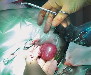 Figure 8. Surgical removal of distended scent gland following chronic infection refractory to medical management.