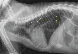 Figure 2. The radiograph in Figure 1 showing thickened bronchial walls in the lungs (yellow arrows) and rib fractures at varying stages of healing (white arrows).
