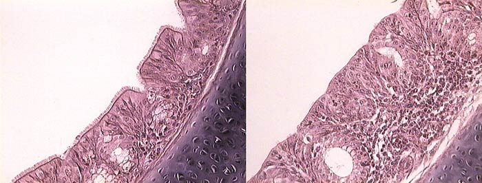Figure 2. Microscopic slides showing a normal tracheal mucosa (left), compared on the right to a mucosa infected with avian metapneumovirus, revealing loss of cilia and mononuclear infiltration. Image: Elena Catelli, University of Bologna.