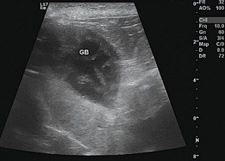 Figure 3. Ultrasound image of a gallbladder mucocele in an eight-year-old border terrier.