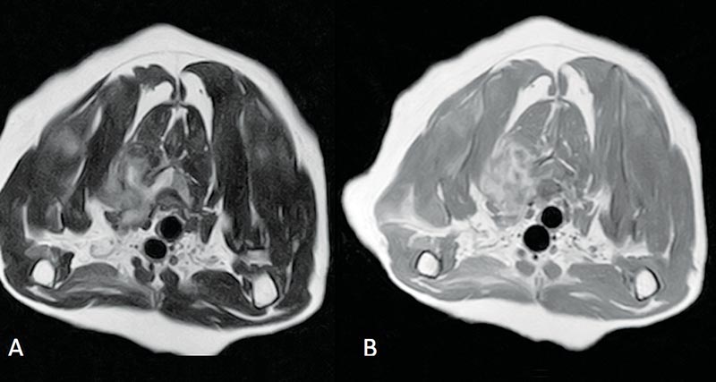 Figure 2. An 11-year-old female neutered domestic shorthair cat with progressive C6 to T2 hemiparesis and cervical pain. (A) Transverse T2-weighted image. Heterogeneously hyperintense mass lesion extending from the left paraxial muscles into the vertebral canal, with severe compression of the spinal cord. (B) Transverse T1-weighted image post-gadolinium. Heterogeneous contrast enhancement of the neoplasia.