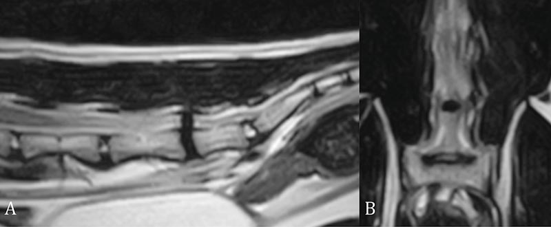 Figure 3. (A) Sagittal T2-weighted image. (B) Dorsal T2-weighted image. Extramedullary compression of the cauda equina due to L6 to L7 intervertebral disc extrusion. 