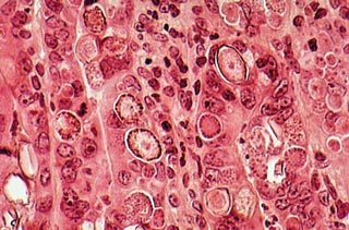 Figure 1. Sexual stages of coccidia (gamonts) within intestinal cells of the large intestine.