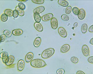 Figure 2. Unsporulated oocysts from sheep faeces.