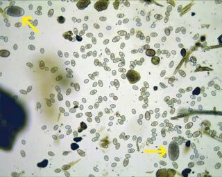 Figure 4. Large numbers of oocysts in faeces do not necessarily indicate disease. These are non-pathogenic Coccidia species from sheep with two worm eggs also present (yellow arrows). The animal was clinically normal.