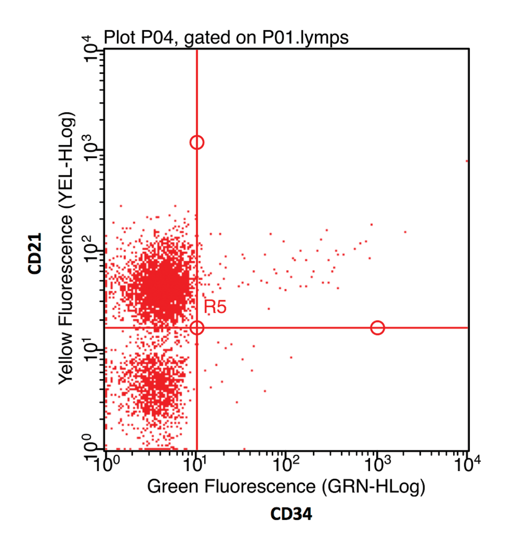 Figure 3c. Scatter plot showing yellow (phycoerythrin; PE) and green (fluorescein isothiocyanate; FITC) fluorescence of cells. Antibody to CD21 is conjugated to PE and antibody to CD34 is conjugated to FITC. Horizontal and vertical lines are prepositioned to enclose the isotype control (negative control) into the lower left quadrant (not shown). Events in the upper left quadrant are positive for the antigen conjugated to PE, events in the lower right are positive for the antigen conjugated to FITC fluorochrome. Events in the upper right co-express both antigens. This demonstrates the overwhelming majority of cells are CD21+ and CD34-.
