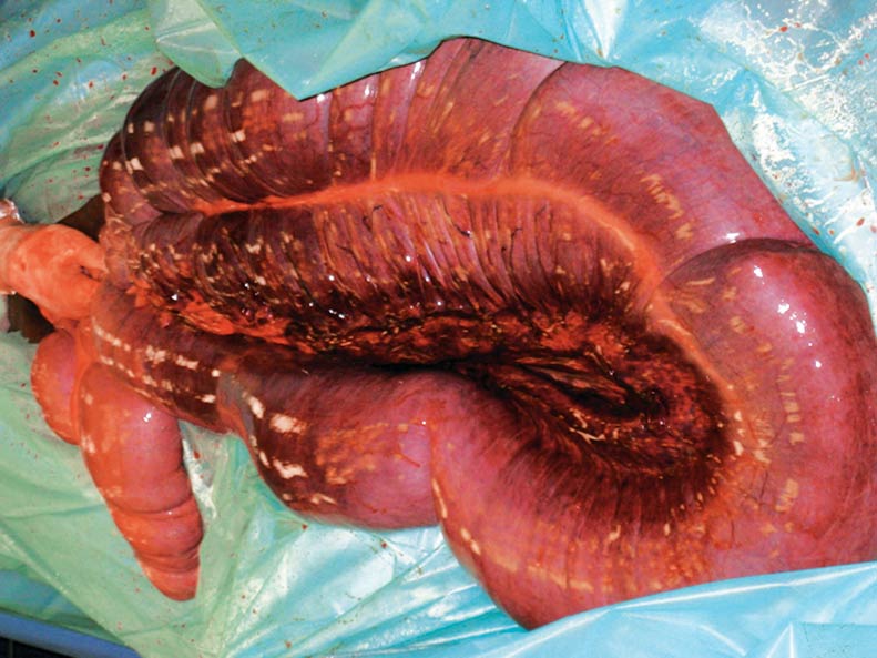 Figure 1. Intraoperative image of a large colon torsion. Torsions that affect the vascular supply of the large colon can produce some of the most rapid and severe changes in clinical parameters, with severe pain, rapid abdominal distension, tachycardia and marked changes in peripheral perfusion occurring in relatively short time periods.