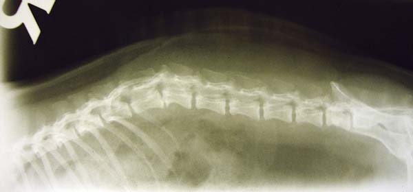 Figure 8. Altered intervertebral spacing and rupture of disc at L1 to L2.