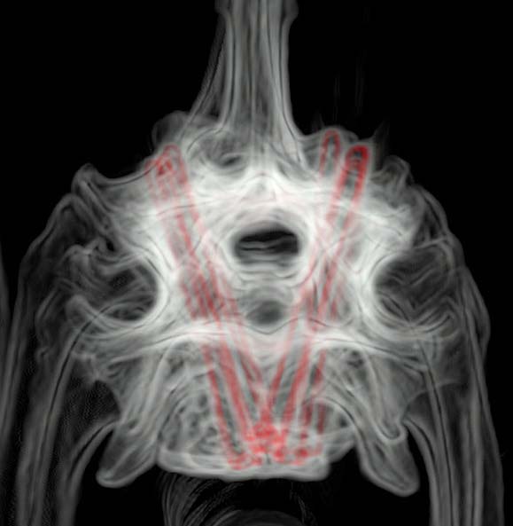 Figure 6a. Transverse postoperative CT scan images (3D rendering with implants highlighted in red) of the neck of a dog with wobbler syndrome treated by ventral stabilisation using titanium screws and bone cement.