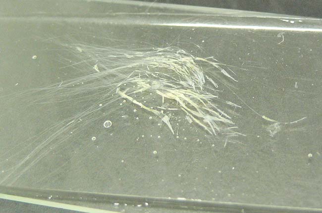 Figure 3. Hair plucks placed in paraffin oil on a microscope slide and under a coverslip.