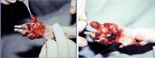 Figure 2. The technique for the phalangeal filleting of the fifth digit to allow the transposition of its pad to the metacarpal pad defect area. Images: Fowler, 2006.