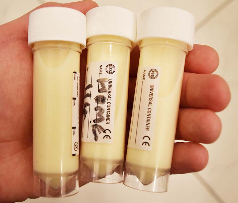 Figure 6. Samples of colostrum can be taken in sterile pots to measure total bacterial counts and total coliform counts, so assess cleanliness.