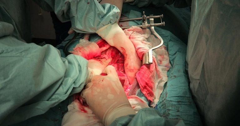 Focus on GDV, part 3: surgery tips | Vet Times Gdv Post Surgery Care At Home