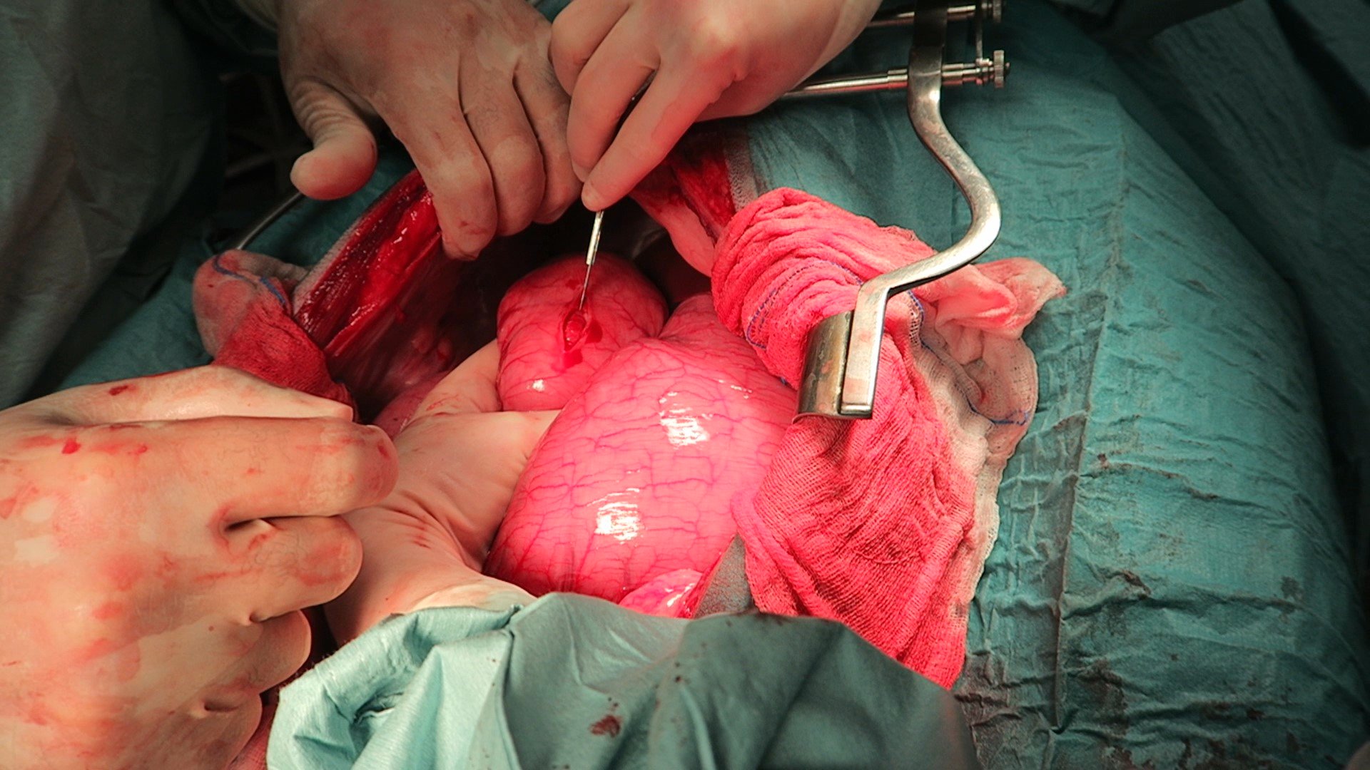Gdv surgery in clearance dogs