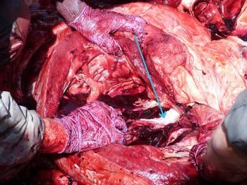 Figure 7. Thrombus being removed from the endocardium and valves of left side of heart (arrow).