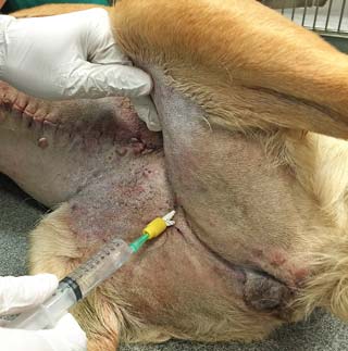 Figure 2. Wound soaker catheter for continuous or intermittent administration of a local anaesthetic (such as bupivacaine) into the wound during the postoperative period.