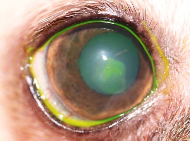 Figure 3. A fluorescein-stained corneal defect.